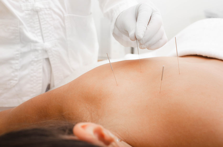 Acupuncture Boosts Depression Relief From SSRIs